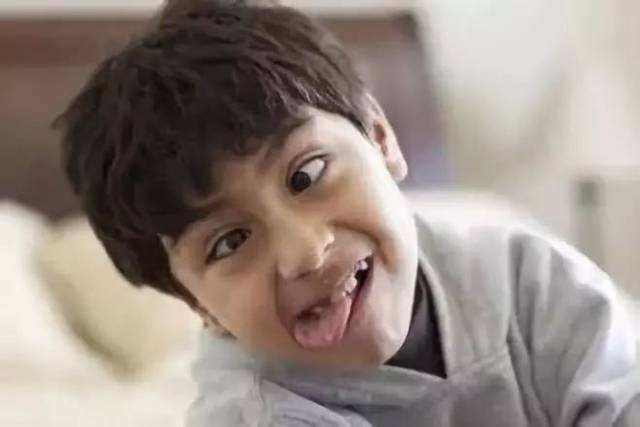 择思达斯_孩子得了抽动症应该如何应对?